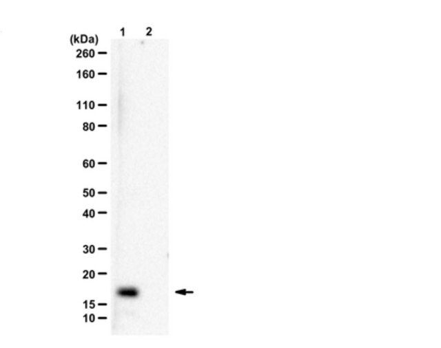 Anti-Histone H3.3 G34R