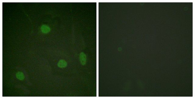 Anti-Histone H3 (Acetyl-Lys<sup>23</sup>) antibody produced in rabbit