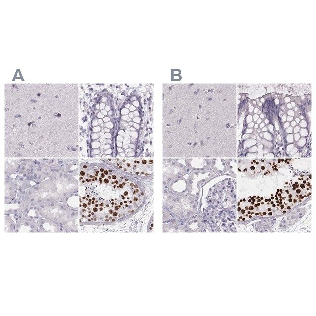 Anti-HIST1H1T antibody produced in rabbit