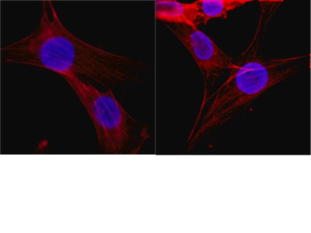 Anti-Histone Antibody, clone H11-4