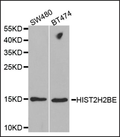 Anti-HIST2H2BE antibody produced in rabbit