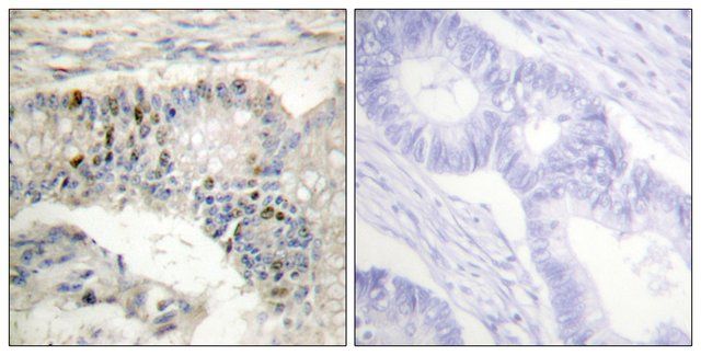 Anti-Histone H1 antibody produced in rabbit