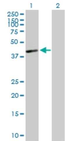 Anti-HLA-C antibody produced in mouse