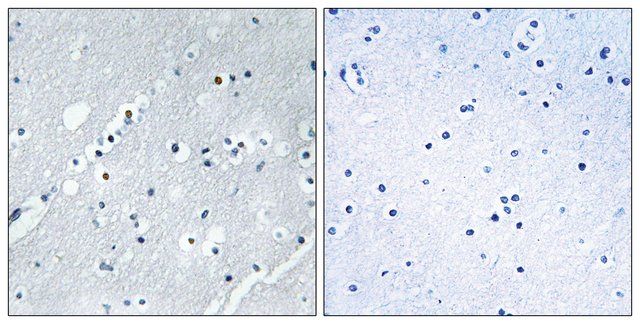 Anti-Histone H2B, N-Terminal antibody produced in rabbit