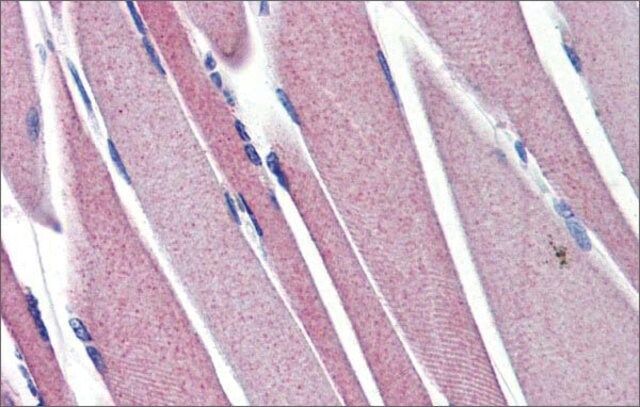 Anti-HK2 antibody produced in rabbit