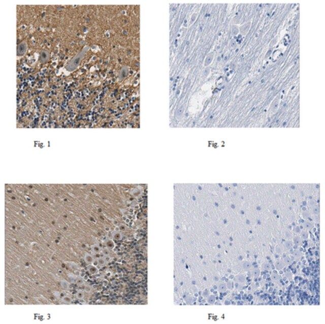 Anti-Histone-lysine N-methyltransferase NSD3 Antibody