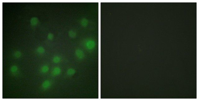 Anti-HKR1 antibody produced in rabbit