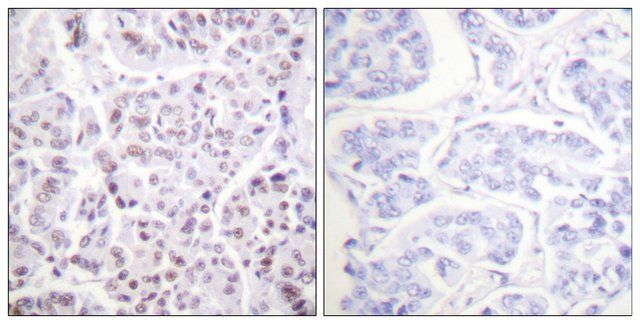 Anti-Histone H4 (Acetyl-Lys<sup>5</sup>) antibody produced in rabbit