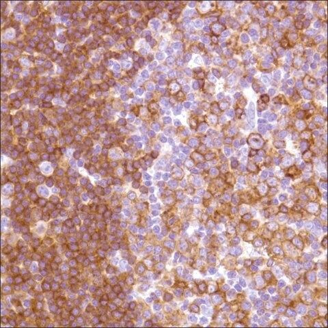 Anti-HLA-DP alpha 1 antibody, Rabbit monoclonal