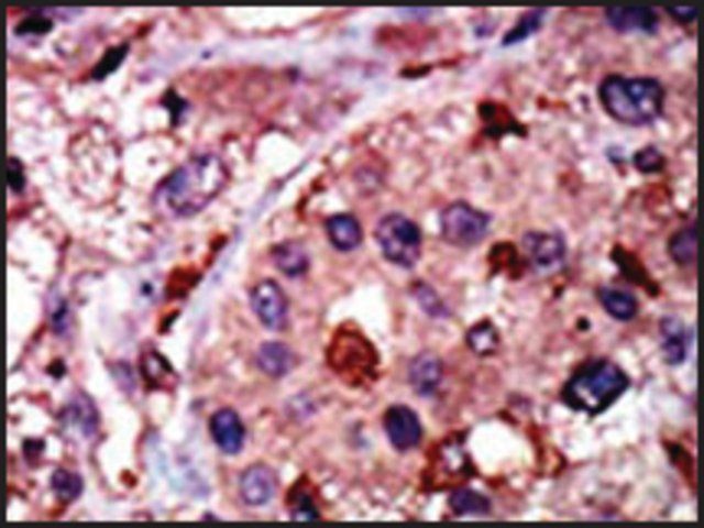 Anti-HK3 (N-term) antibody produced in rabbit