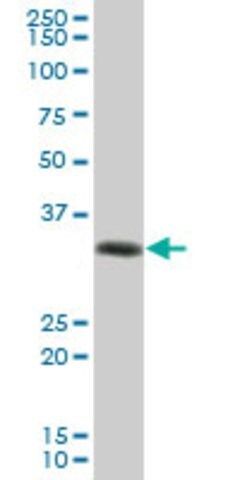 Anti-HLA-DRA antibody produced in mouse