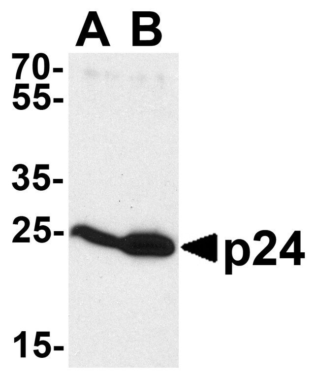 Anti-HIV-1 P24 antibody produced in rabbit