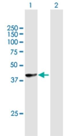 Anti-HLA-B antibody produced in mouse