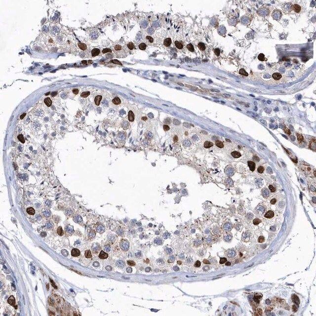 Anti-HKR1 antibody produced in rabbit