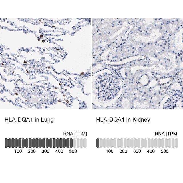 Anti-HLA-DQA1 antibody produced in rabbit