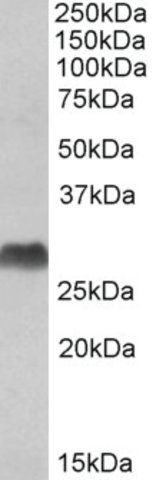 Anti-HLA-DQA2 (C-terminal) antibody produced in goat