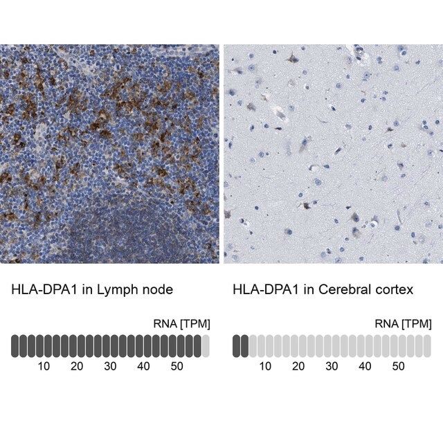 Anti-HLA-DPA1 antibody produced in rabbit