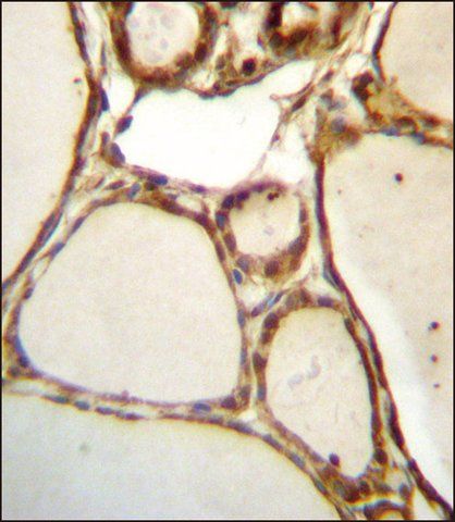 ANTI-HJURP (C-TERM) antibody produced in rabbit