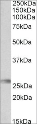 Anti-HLA-DQA2 antibody produced in goat