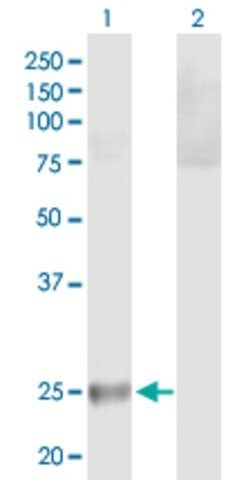 Anti-HLA-DQB2 antibody produced in mouse