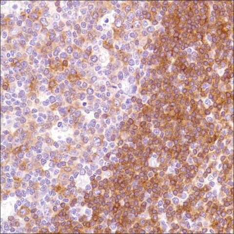 Anti-HLA-DP beta 1 antibody, Rabbit monoclonal