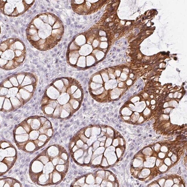 Anti-GTF2H3 antibody produced in rabbit