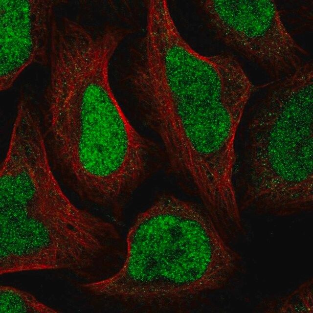 Anti-GTF2IRD2B antibody produced in rabbit