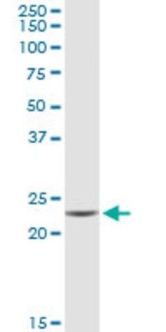 Anti-GUK1 antibody produced in rabbit