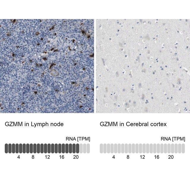 Anti-GZMM antibody produced in rabbit