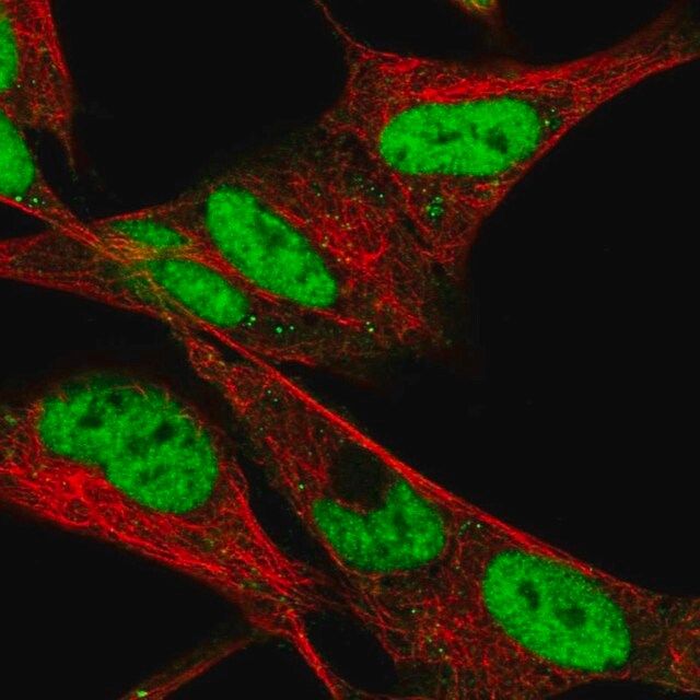 Anti-HAND2 antibody produced in rabbit