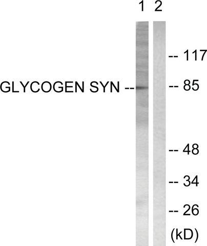 Anti-Glycogen Synthase, C-Terminal antibody produced in rabbit