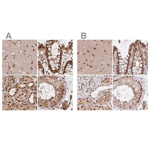 Anti-GLYR1 antibody produced in rabbit