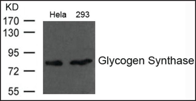 Anti-Glycogen Synthase antibody produced in rabbit