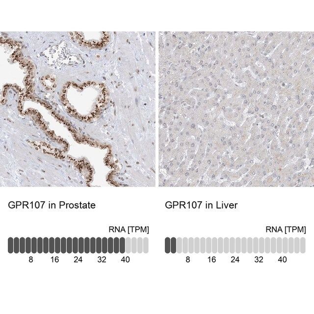 Anti-GPR107 antibody produced in rabbit