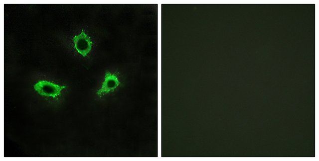 Anti-GPR115 antibody produced in rabbit