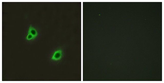 Anti-GPR126 antibody produced in rabbit