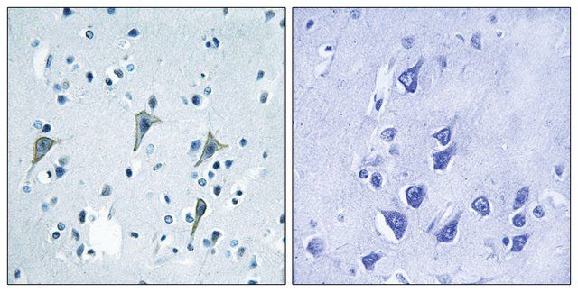 Anti-GPR85 antibody produced in rabbit