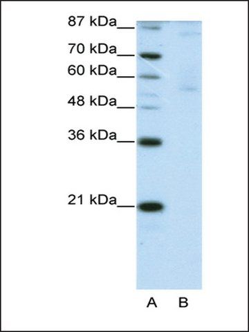 Anti-ZNF92 (AB2) antibody produced in rabbit