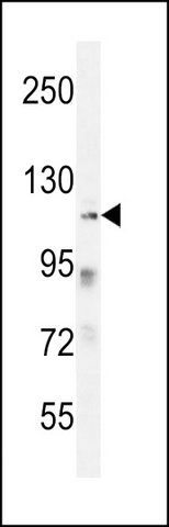 ANTI-ZNF99 (N-TERM) antibody produced in rabbit