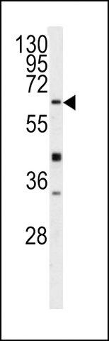 ANTI-GGTLA1(N-TERMINAL) antibody produced in rabbit