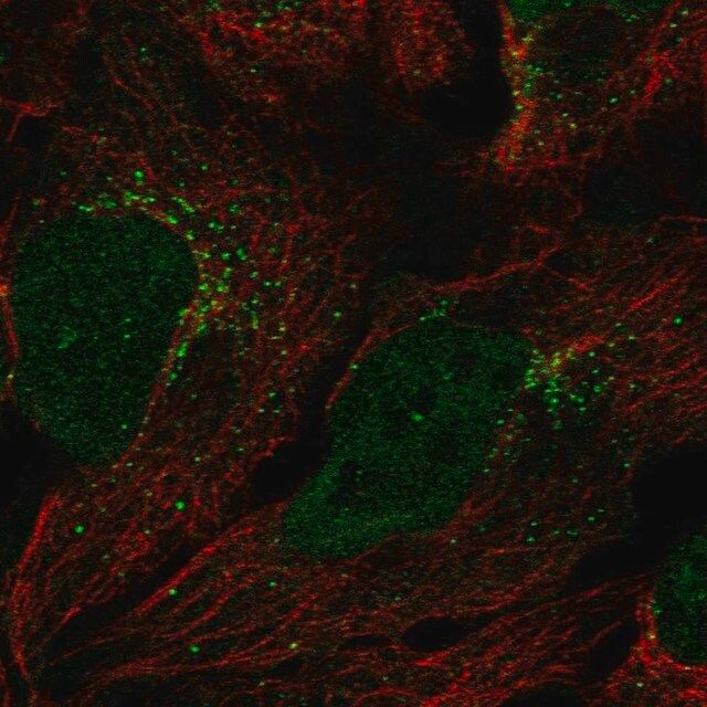 Anti-GGT7 antibody produced in rabbit