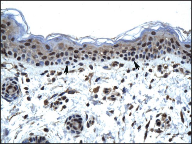 Anti-ZNFN1A5 antibody produced in rabbit