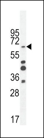 ANTI-ZNF98 (C-TERMINAL) antibody produced in rabbit