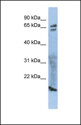 Anti-ZP1 antibody produced in rabbit