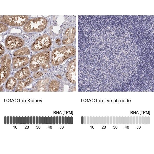 Anti-GGACT antibody produced in rabbit