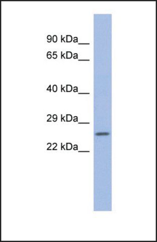 Anti-ZNRF1, (N-terminal) antibody produced in rabbit