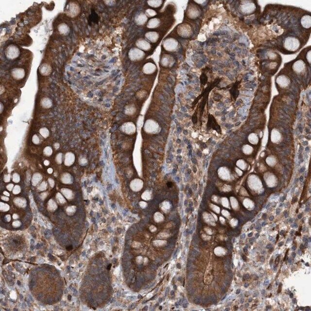 Anti-GGT6 antibody produced in rabbit