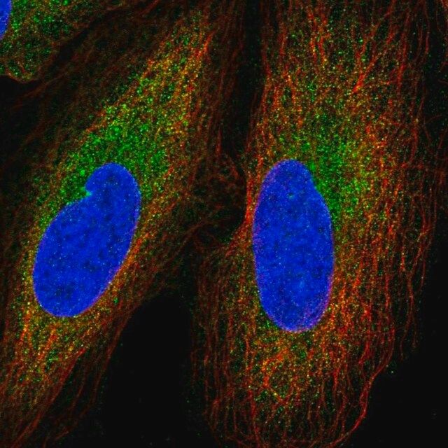 Anti-GGNBP2 antibody produced in rabbit