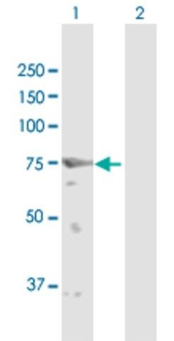 Anti-GFPT2 antibody produced in rabbit