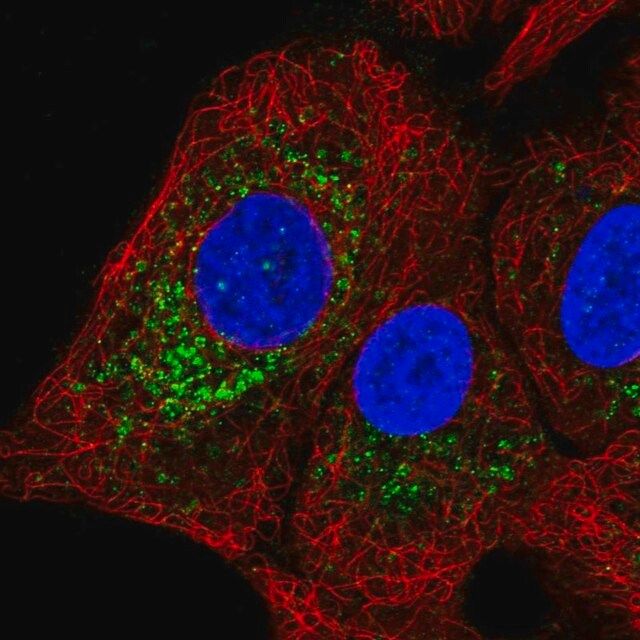 Anti-GGT1 antibody produced in rabbit